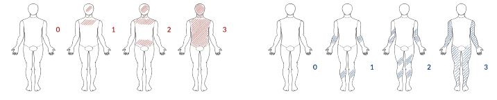 Guidance on scoring Atopic Eczema.